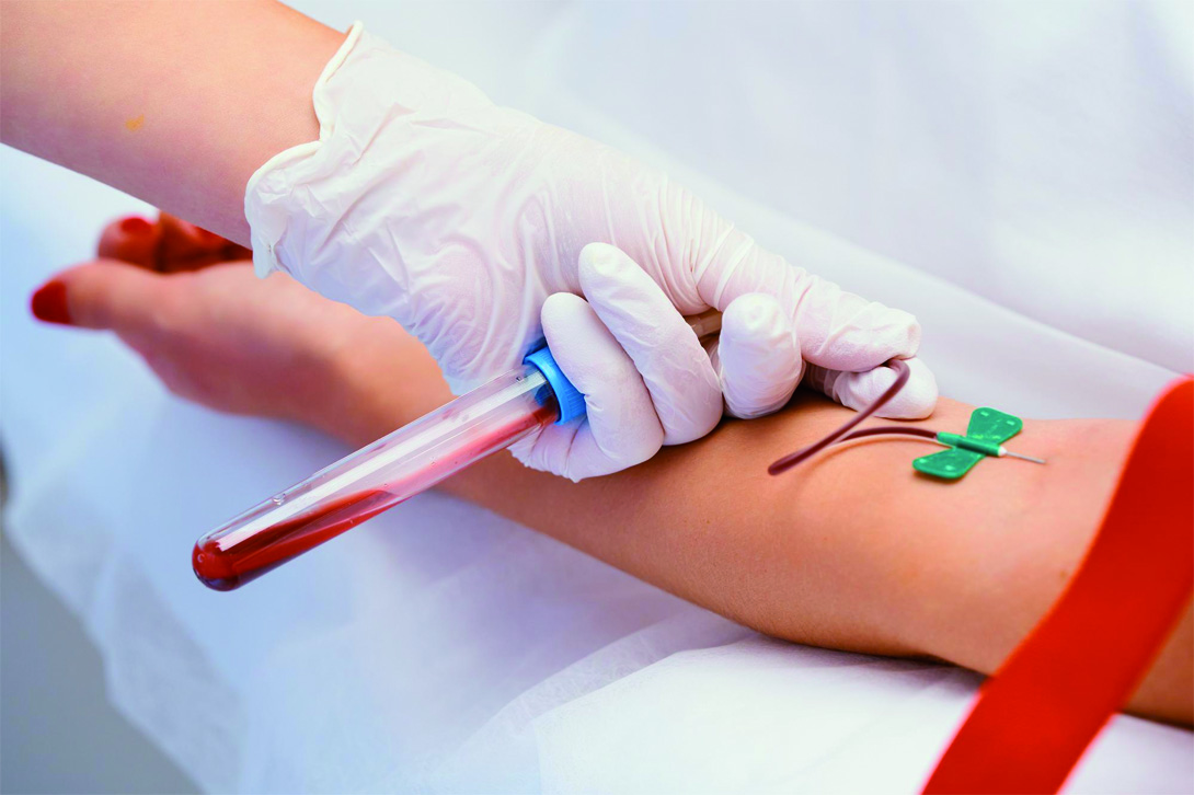 Blutentnahme